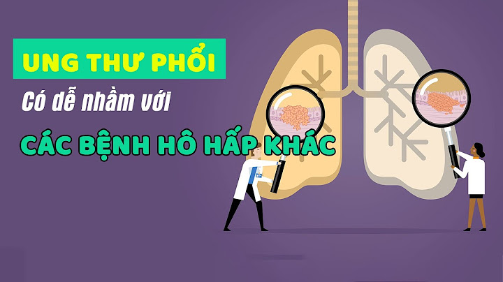 Hướng dẫn người bệnh khạc đờm bệnh viện 30 4