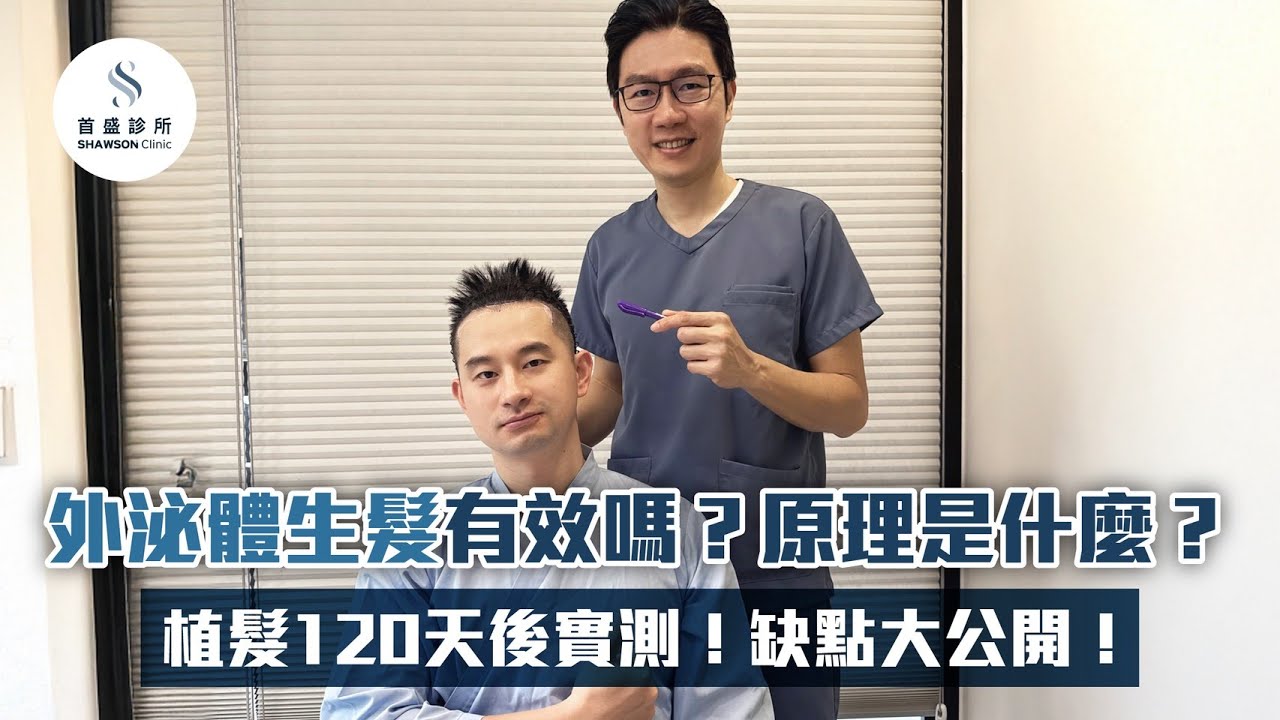 外泌體生髮有效嗎？原理是什麼？植髮120天後實測，直接施作給你看！ feat. 警察文豪