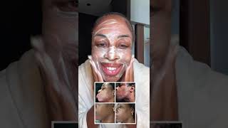 How to get rid of acne FAST