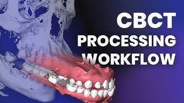 CBCT Processing Workflow in MeshInspector