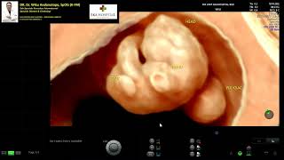 EMBRYO NORMAL 7-8 WEEKS (Dr Wiku Andonotopo)