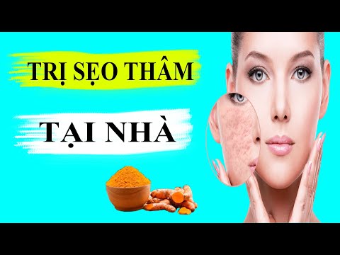 [ Top 3  ] Cách Trị Sẹo Thâm Tại Nhà Hiệu Quả 100%