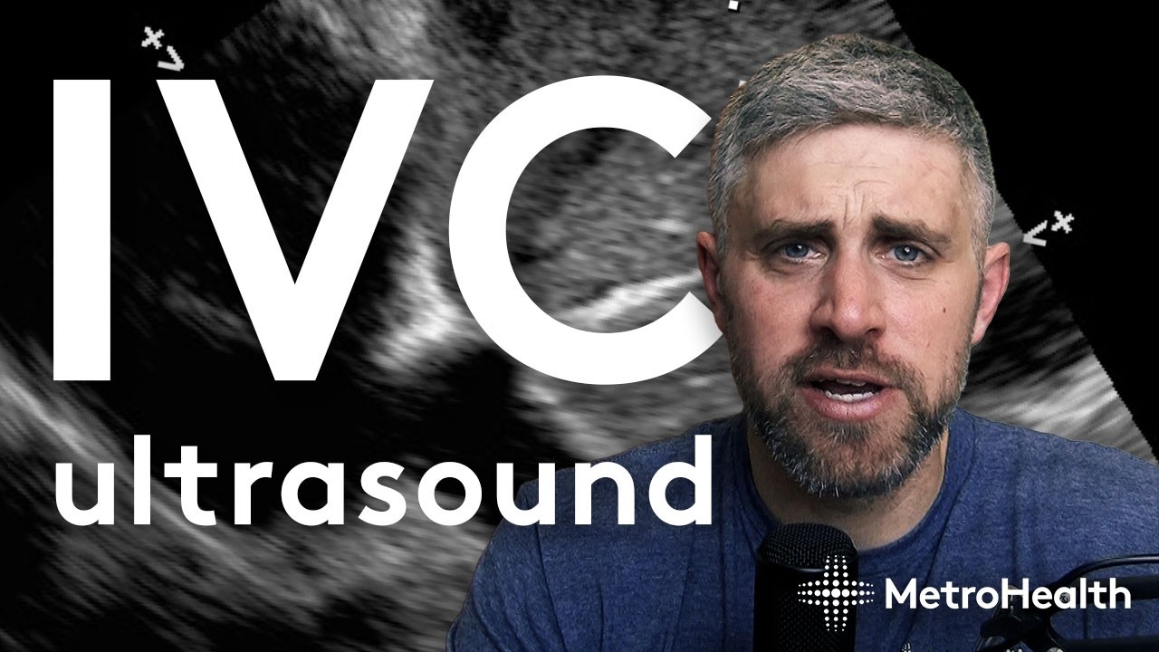 IVC POCUS for Fluid Assessment