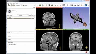3D Slicer ruler and orientation marker refactoring