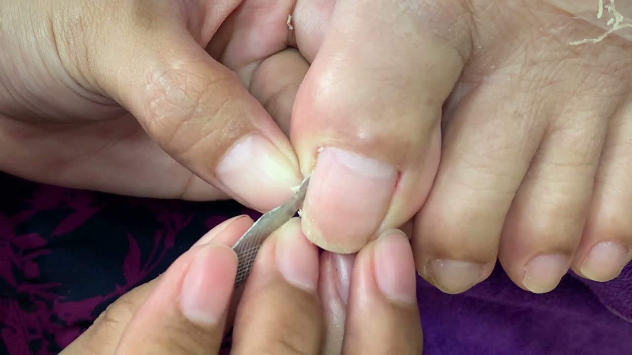 How to Repair Nails easy 360 YouTube