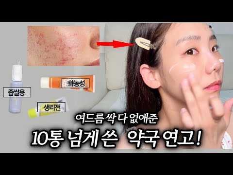 가장 효과 봤던 약국 연고! #여드름연고