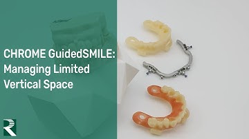 CHROME GuidedSMILE: Managing Limited Vertical Space