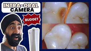 Budget IntraOral Camera Review: Surprisingly Good! FocusDent MD740