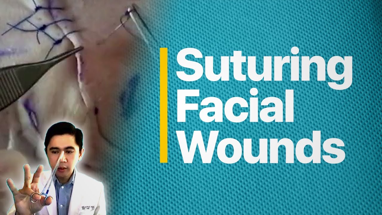 Suturing Facial Lacerations YouTube