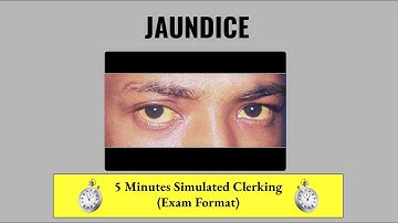 JAUNDICE - Simulated Exam- Format History Taking
