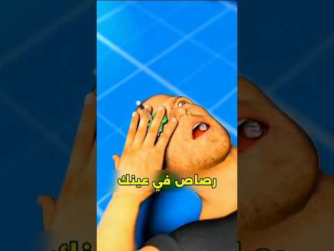 قلم رصاص في العين لا تسحبه ما تفعل فور ا 