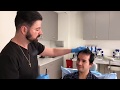 Best FUE Hair Transplant in Los Angeles, CA. Best FUE Hair Restoration in LA, Beverly Hills