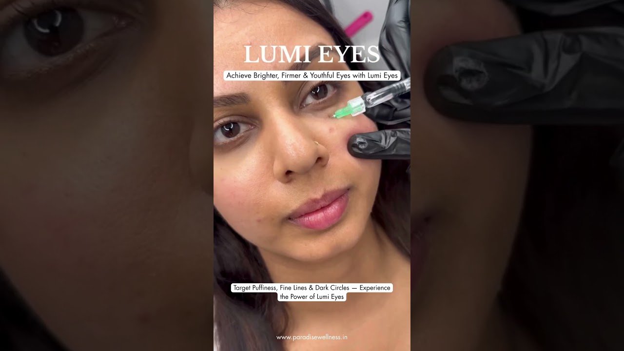 Lumi Eye Treatment Everything You Need to Know for Brighter, Younger-Looking Eyes