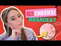 Top 8 ingredients to treat redness  rosacea from a dermatologist  dr shereene idriss
