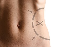 Liposuction Nasıl Yapılır? Acılı Bir Yöntem Midir?