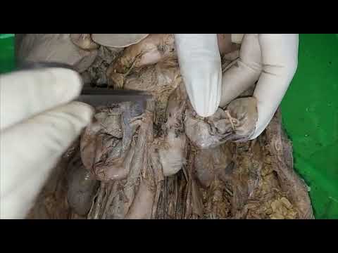 ANATOMY OF THE  DUODENUM -- DISSECTION OVERVIEW