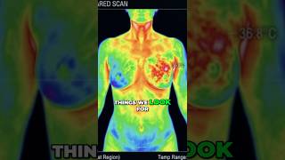 Piece of Mind With Thermography A Heat Map of Your Body