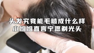 头发究竟能毛糙能什么样？小姐姐直言宁愿剃光头