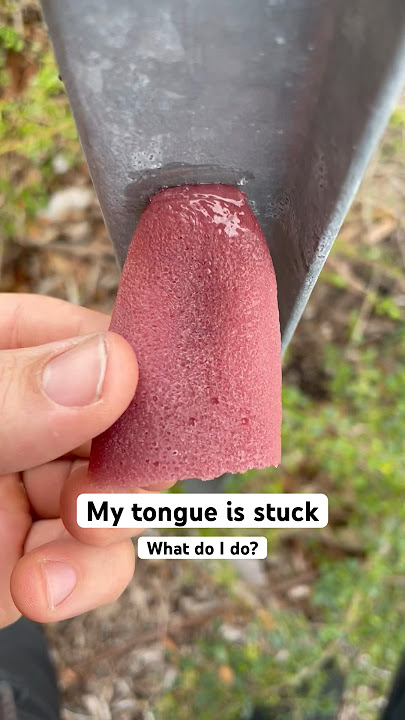 What did you do with your tongue today? #medical #health #winter