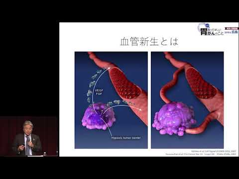 胃がんの化学療法～上手に化学療法を受けるために～　篠崎 勝則