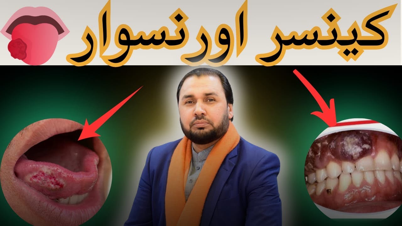 Naswar | Snuff and Cancer! 