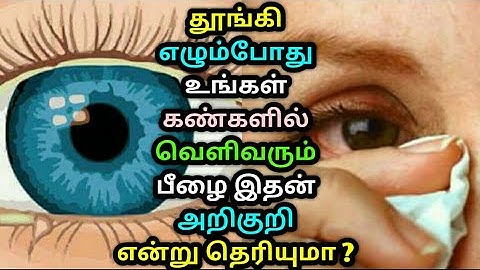 தூங்கி எழும்போது உங்கள் கண்களில் வெளிவரும் பீழை இதன் அறிகுறி என்று தெரியுமா ? Eyes | Kanpilai reason