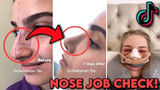 Nose Job Check | TikTok Compilation