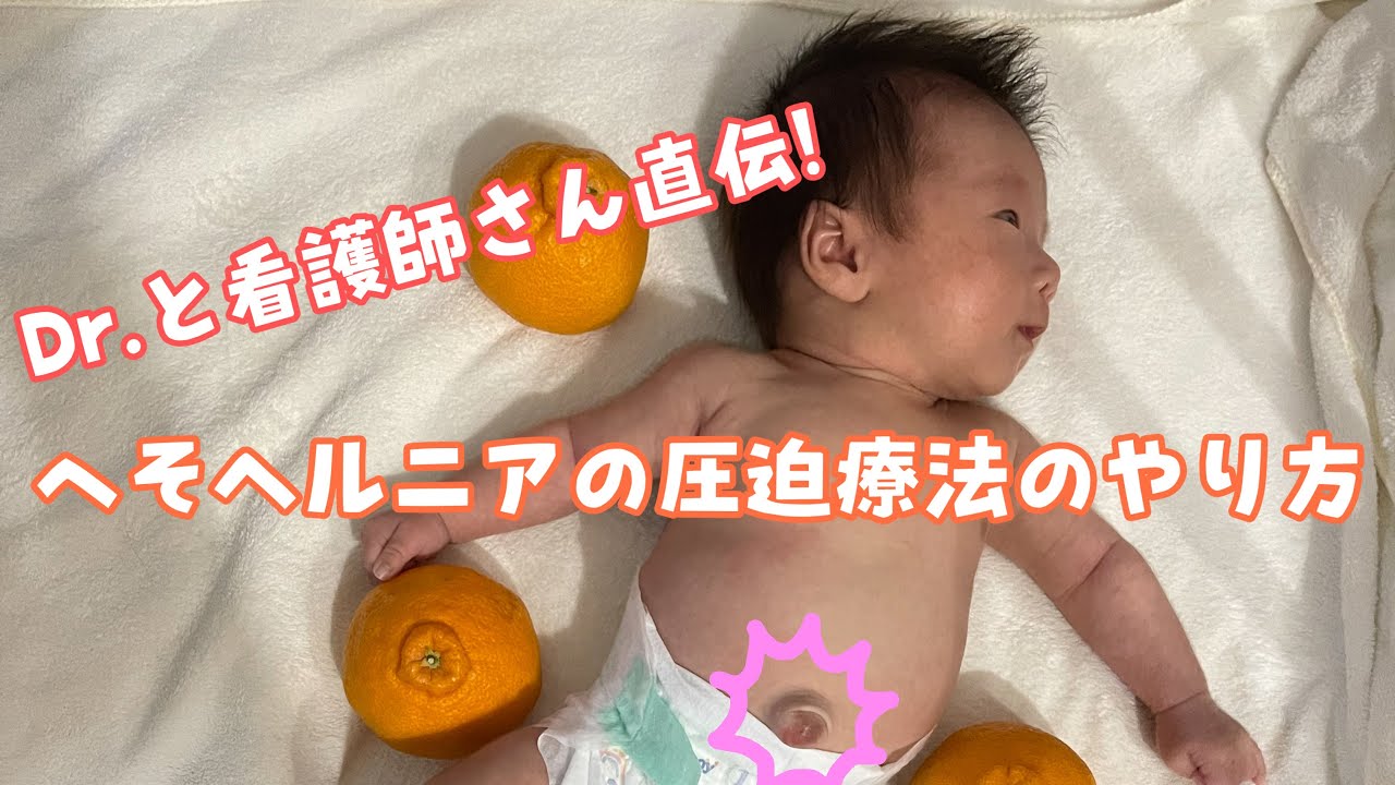 臍ヘルニア Dr に教えてもらった簡単な圧迫療法のやり方 コスパ とコスパ の2パターン Youtube