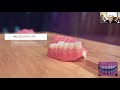 The Three Appointment Digital Denture