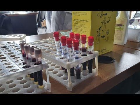 ეპიდემიოლოგიური  ვითარება მსოფლიოში