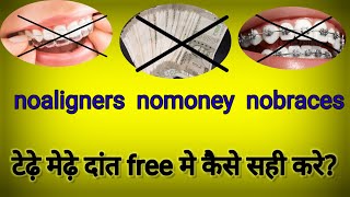 टढ मढ दत सध करनक घरल उपयबहर नकल हए दतक बन तर लगय Freeम कस सह कर?