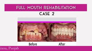 Transform Your Smile with Expert Dental Care | best dental clinic in ludhiana