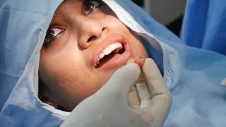 Getting My Wisdom Teeth Removed At Richardsons