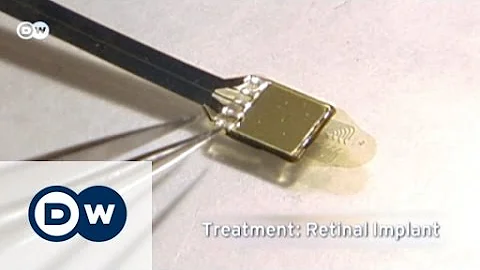 An implant helps the blind see | Tomorrow Today