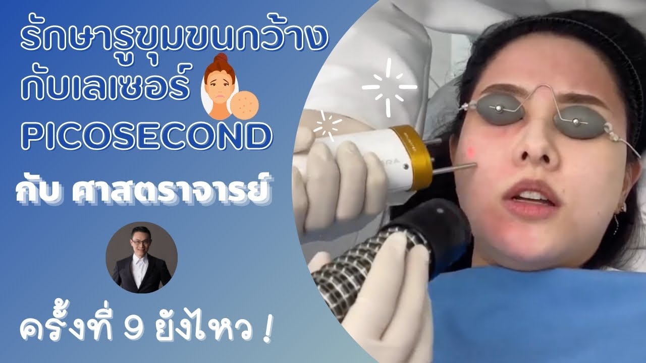 เลเซอร์รูขุมขนกว้างที่ดีที่สุด ? PICOSECOND LASER | erk-erk