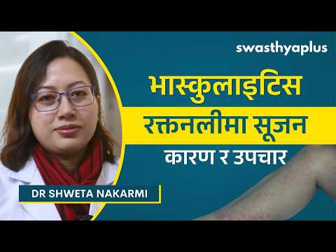 भास्कुलाइटिस: रक्तनलीमा सूजन, कारण र उपचार | Vasculitis: How to Treat? in Nepali |Dr Shweta Nakarmi