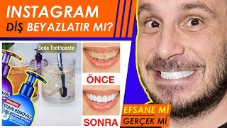 DİŞ BEYAZLATMA MUCİZESİ EFSANE Mİ GERÇEK Mİ? | MUCİZE INSTAGRAM  DİŞ MACUNU STAIN REMOVAL