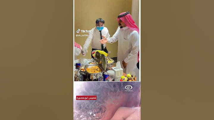 طفل يفارق الحياة بين ذراعي والده بسبب المجاعة التي تضرب غزة. وشيوخ الطغاة يتفاخرون بموائدهم