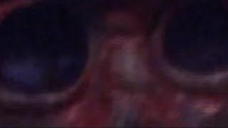 agn0sia- Interlude/Misanthrope (Video)
