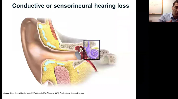 WEBINAR: Inner Ear Gene Therapy – Recent Advances and Clinical Perspectives