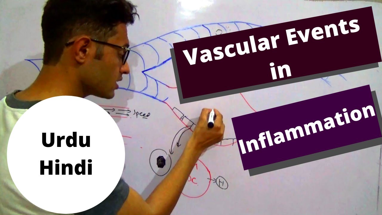 Vascular Events Of Acute Inflammation Increased Vascular Permeability