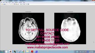Brain Tumor Segmentation using Convolutional Neural Networks in MRI Images