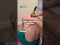 Getting rid of those trap and upper back knots #shockwave #backpainrelief #neckpainrelief