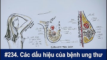 #234. Ung thư có những dấu hiệu nào và các loại BS chữa trị ung thư