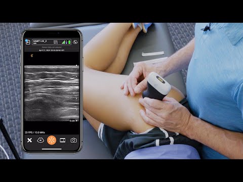 Image of Dry Needling Gluteus Medius Tendon