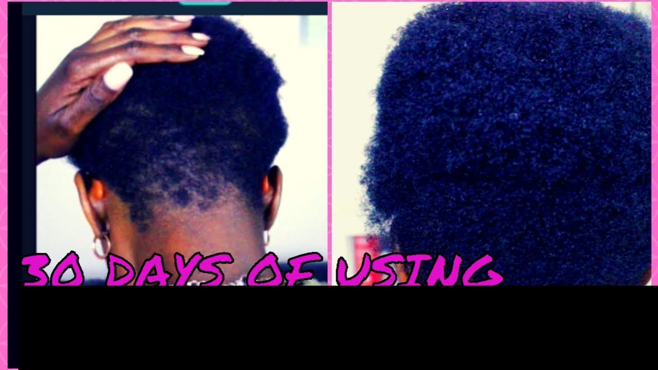 30 days of using jeba hair fertilizer results YouTube