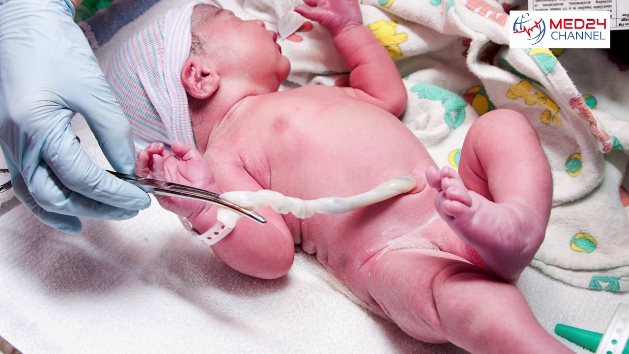 Cellule staminali del cordone ombelicale donazione o conservazione? YouTube