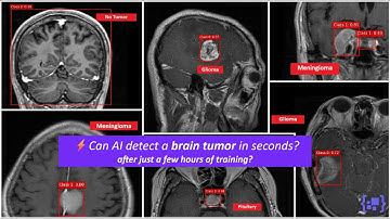 AI Detects Brain Tumors in Seconds | Trained in Hours, No Coding Required