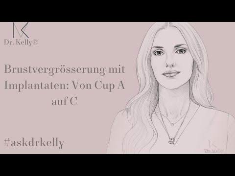 Brustvergrösserung mit Implantaten: Von Cup A auf Cup C