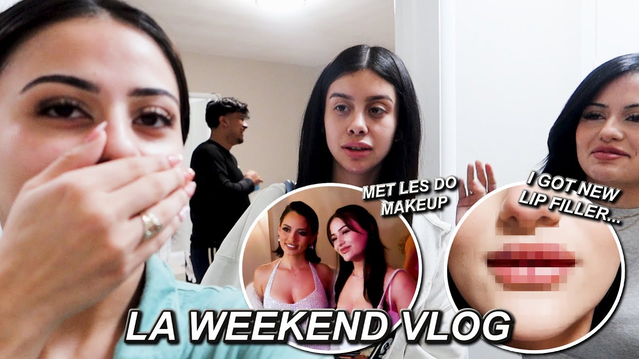 WEEKEND IN LA VLOG | lesdomakeup launch, lip filler *lit af*